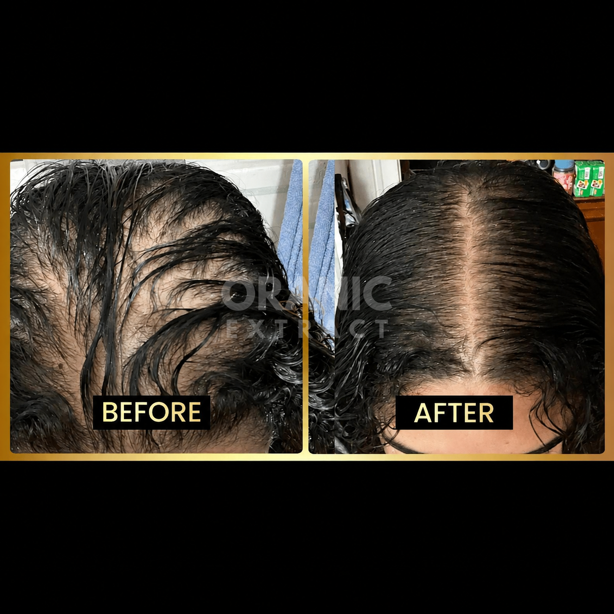 ORANIC EXTRACT® JUMBO Scalp Stimulator